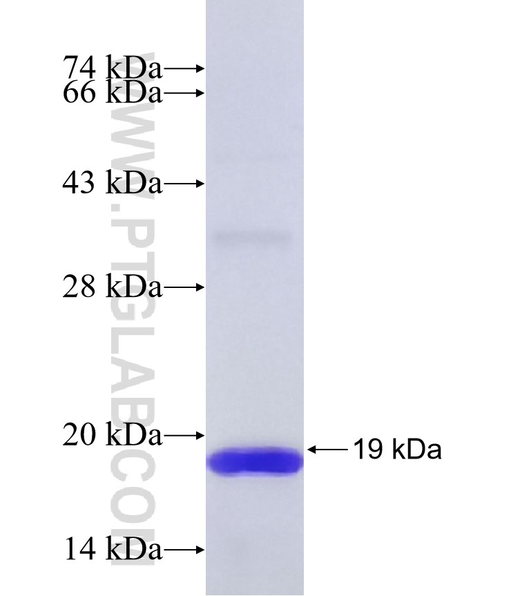 MYO19 fusion protein Ag41038 SDS-PAGE MYO19 fusion protein Ag41038 SDS-PAGE