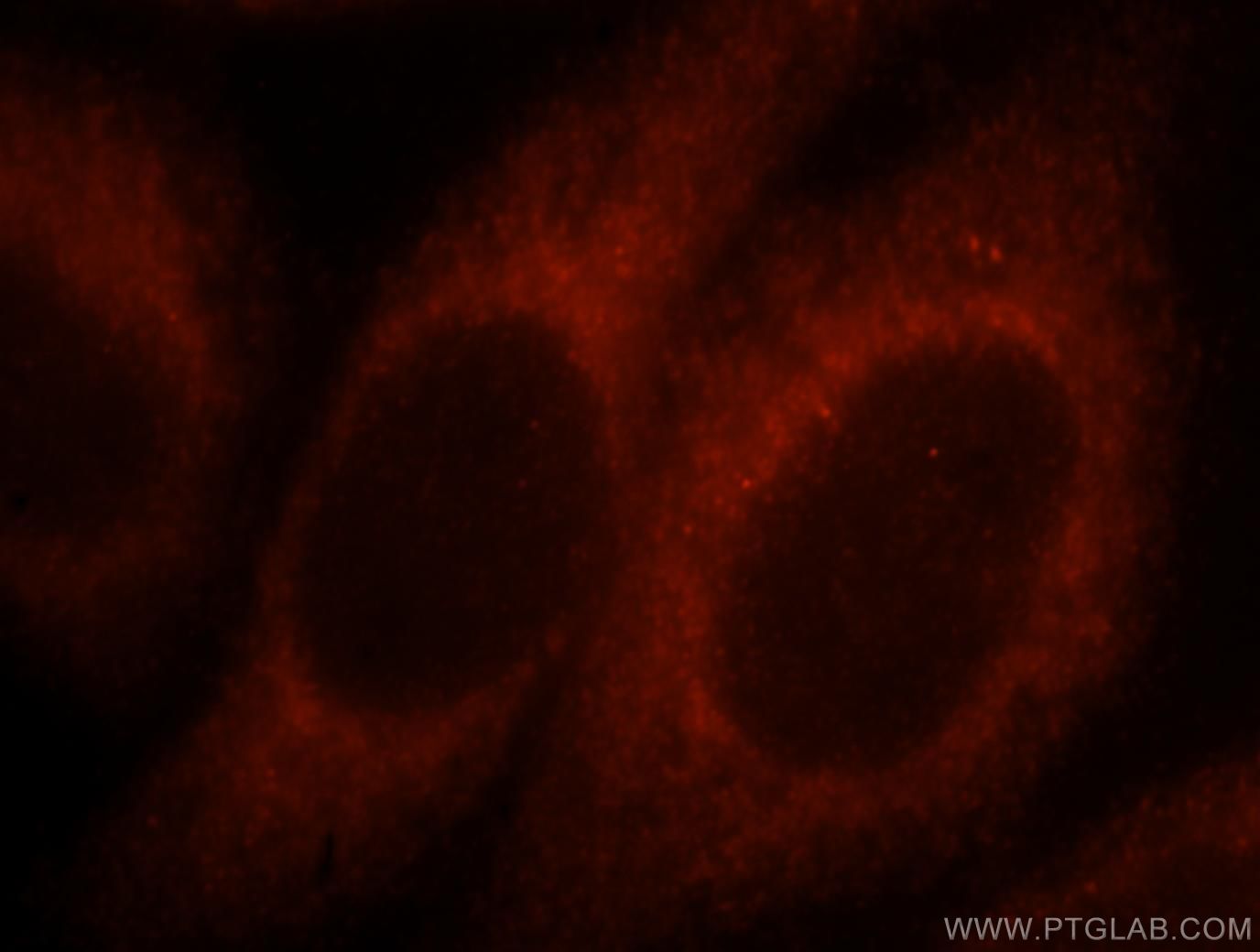 IF Staining of HepG2 using 17499-1-AP