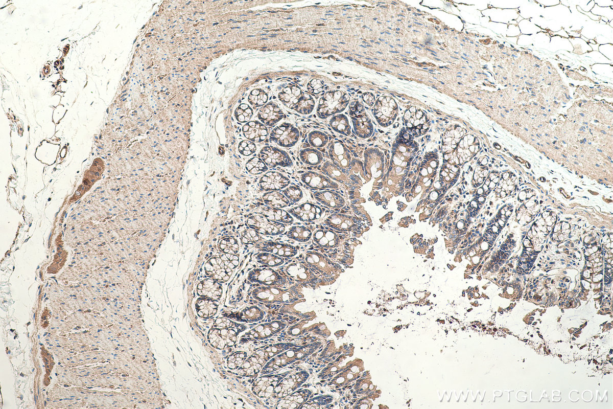 IHC staining of rat colon using 17969-1-AP