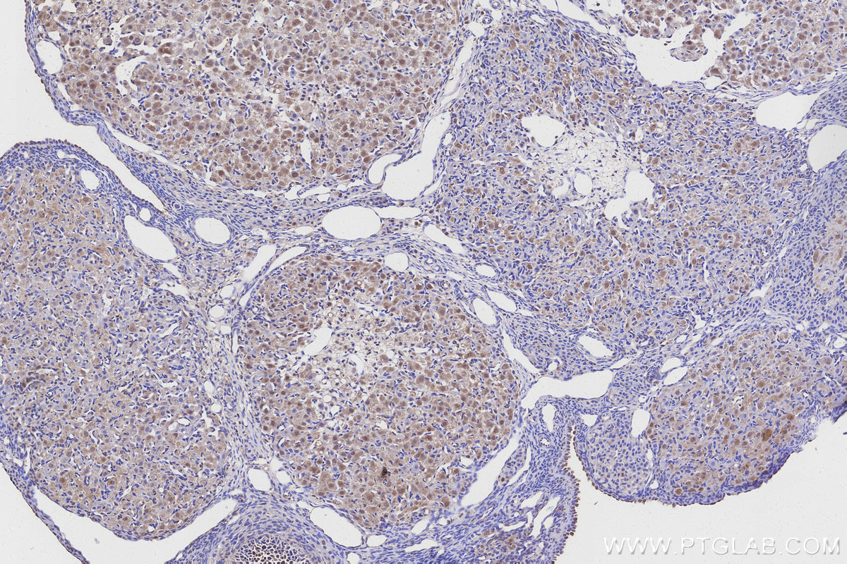 IHC staining of rat ovary using 14028-1-AP IHC staining of rat ovary using 14028-1-AP