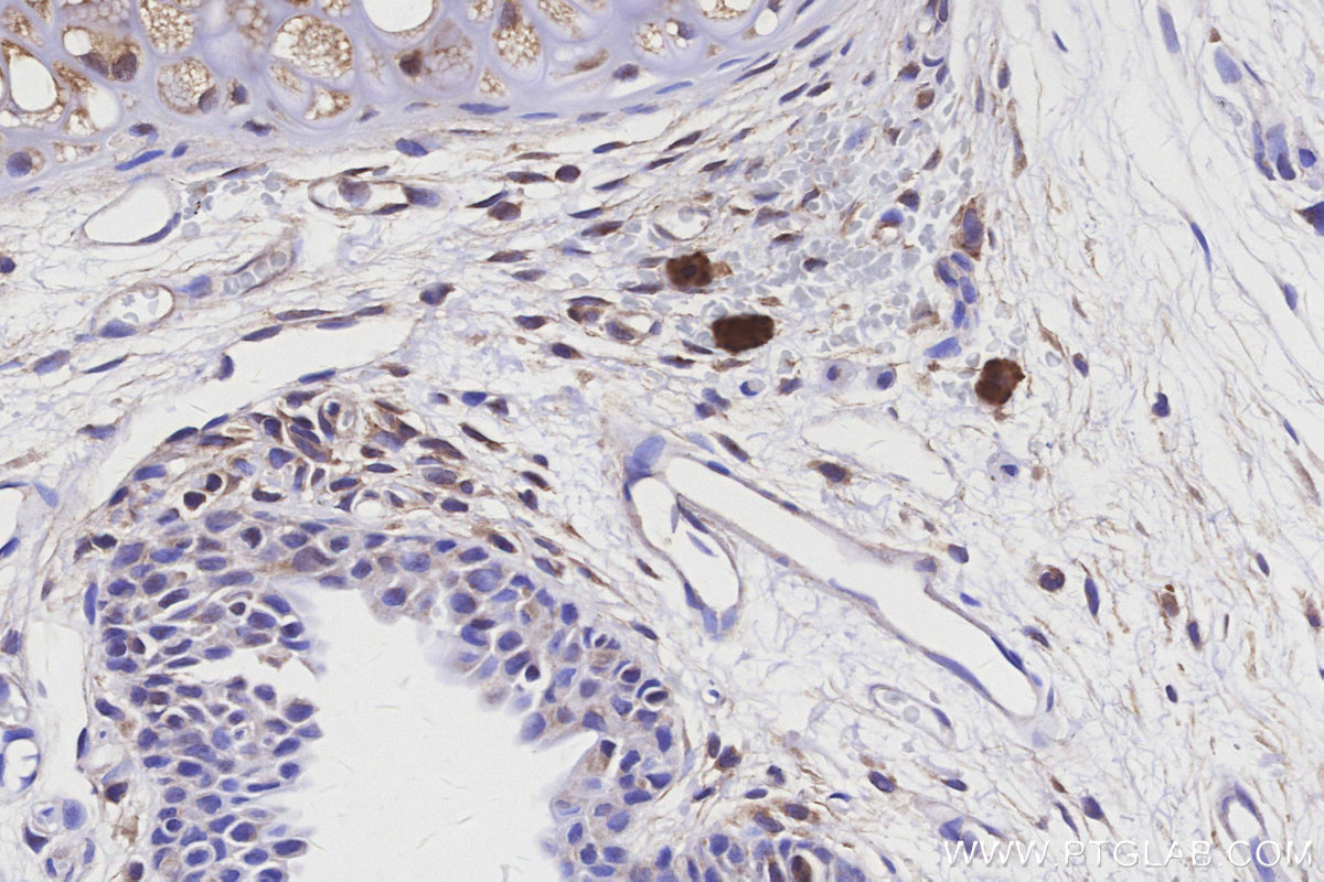 IHC staining of rat thyroid gland using 14028-1-AP IHC staining of rat thyroid gland using 14028-1-AP