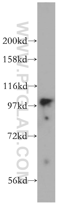 WB analysis of mouse lung using 14028-1-AP