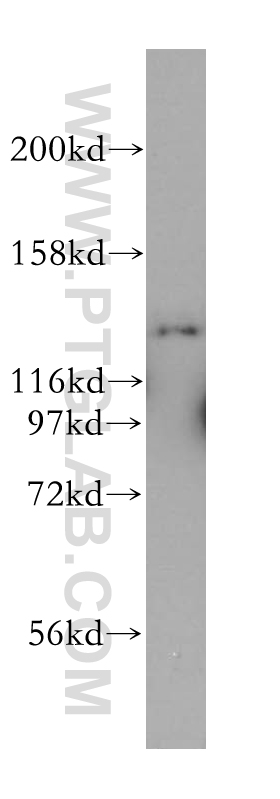 WB analysis of HeLa using 17768-1-AP