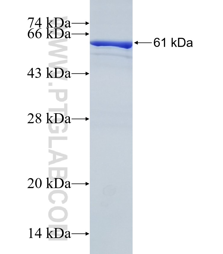 MYO1E fusion protein Ag12176 SDS-PAGE