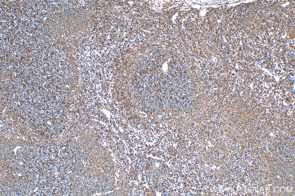 IHC staining of mouse spleen using 28841-1-AP IHC staining of mouse spleen using 28841-1-AP