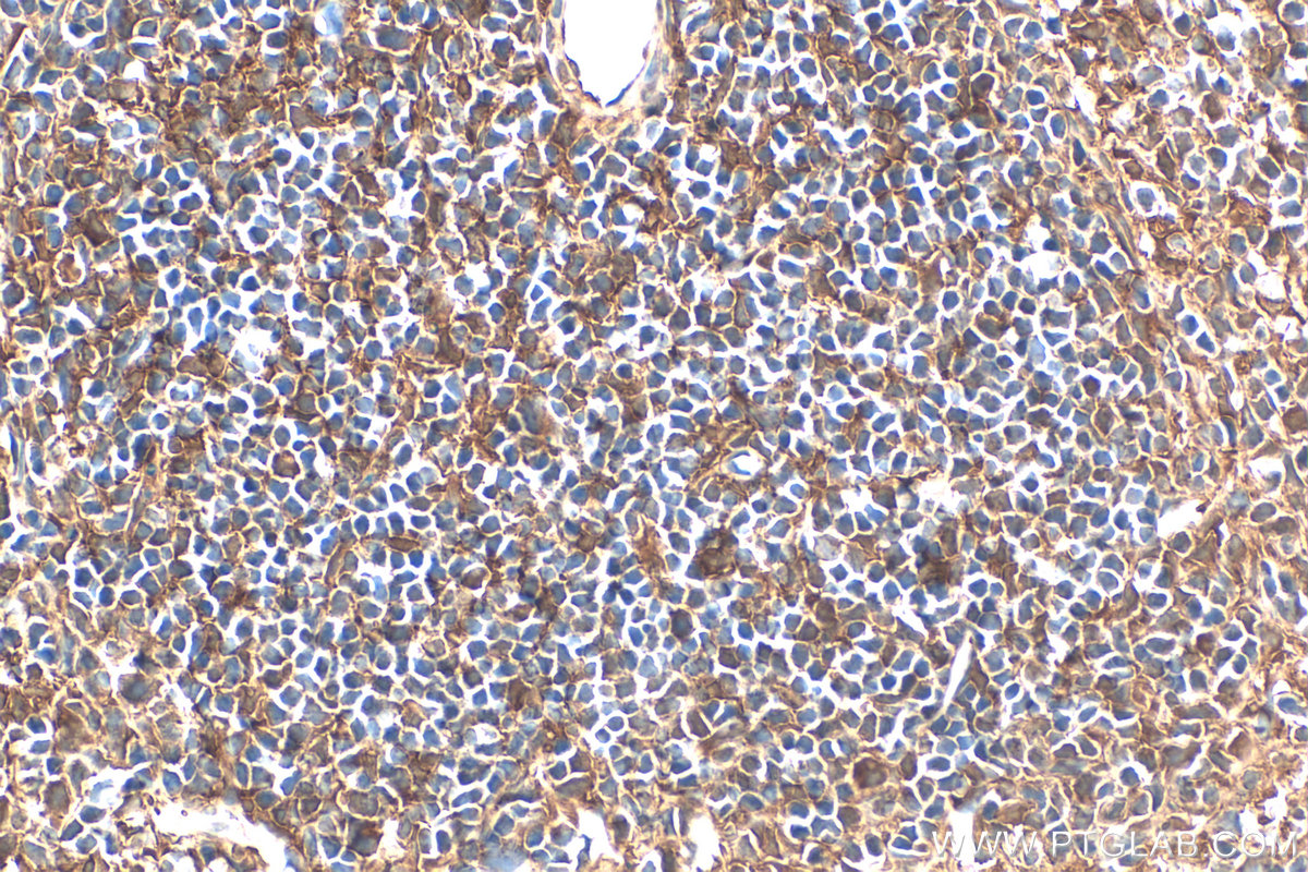 IHC staining of mouse spleen using 28841-1-AP IHC staining of mouse spleen using 28841-1-AP
