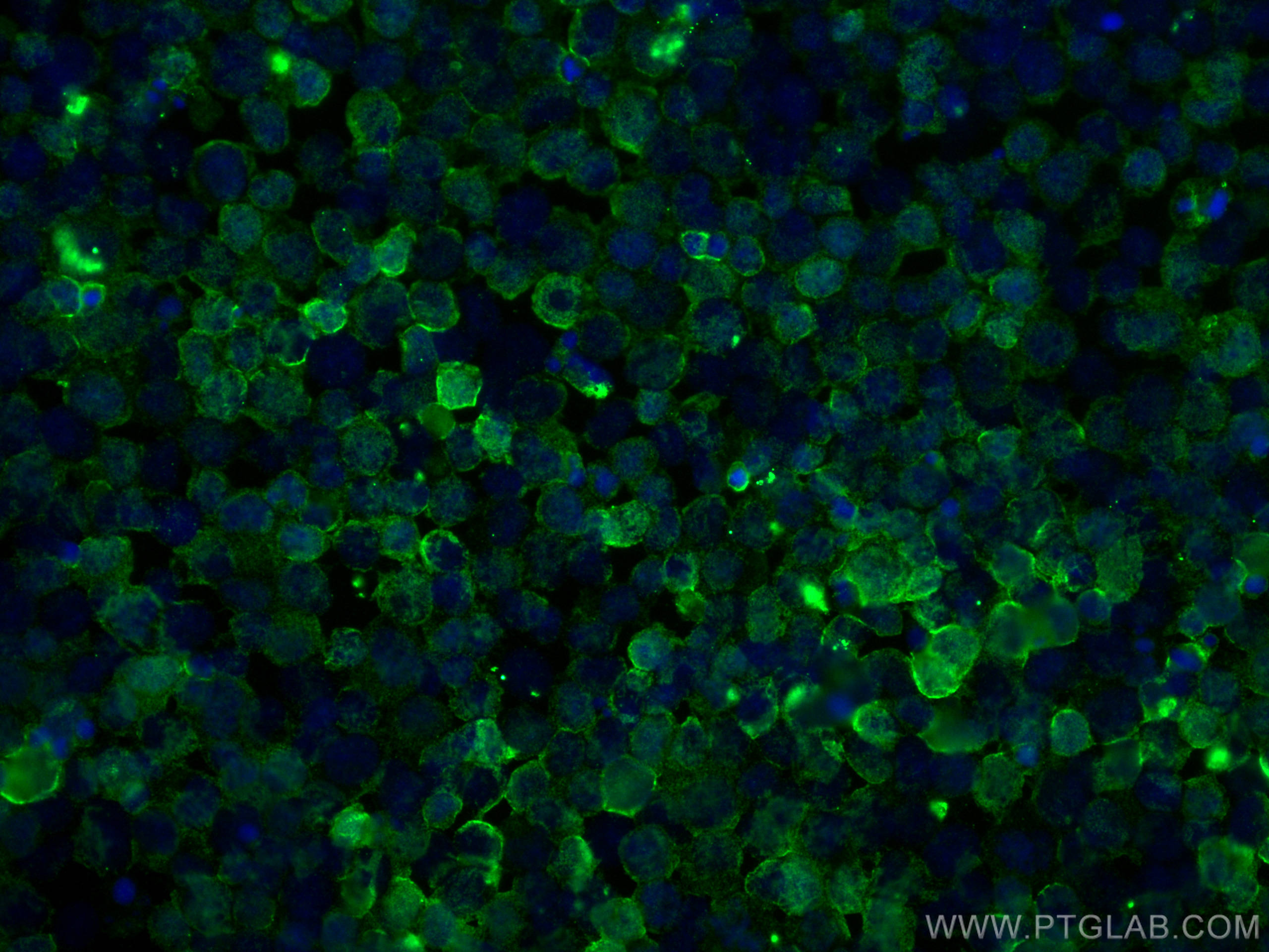 IF Staining of Jurkat using 25772-1-AP