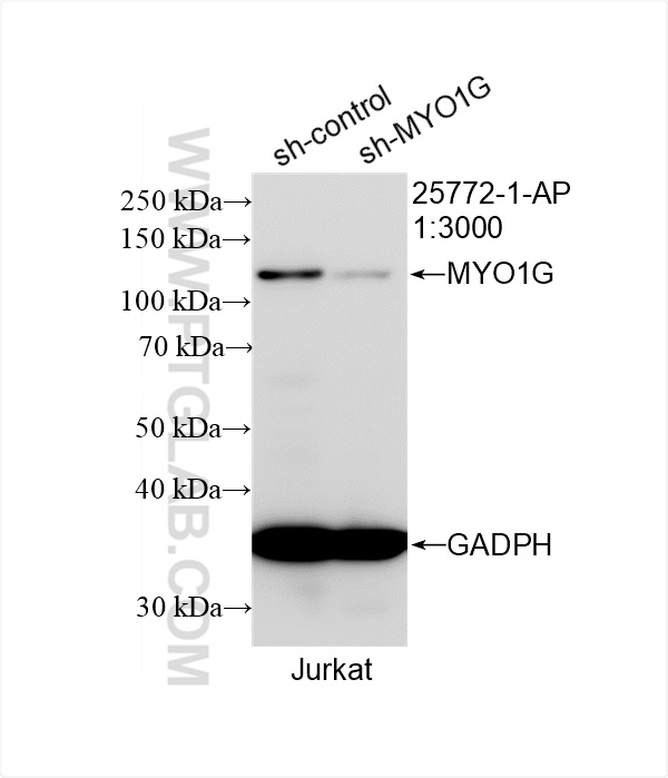 WB analysis of Jurkat using 25772-1-AP (same clone as 25772-1-PBS)