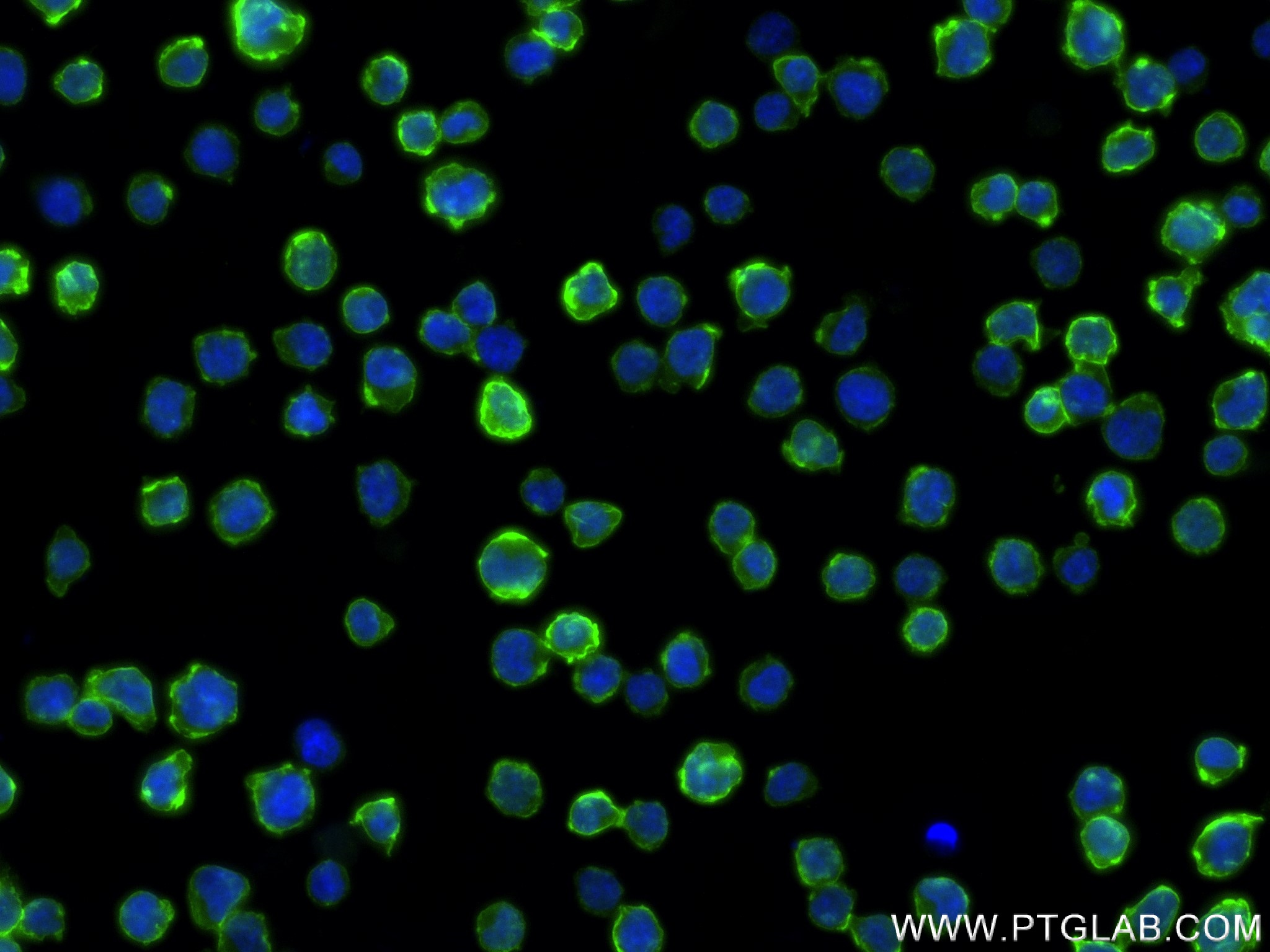 IF Staining of Jurkat using 83556-5-RR