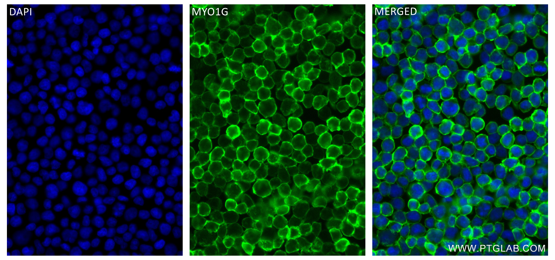 IF Staining of Jurkat using 83556-5-RR