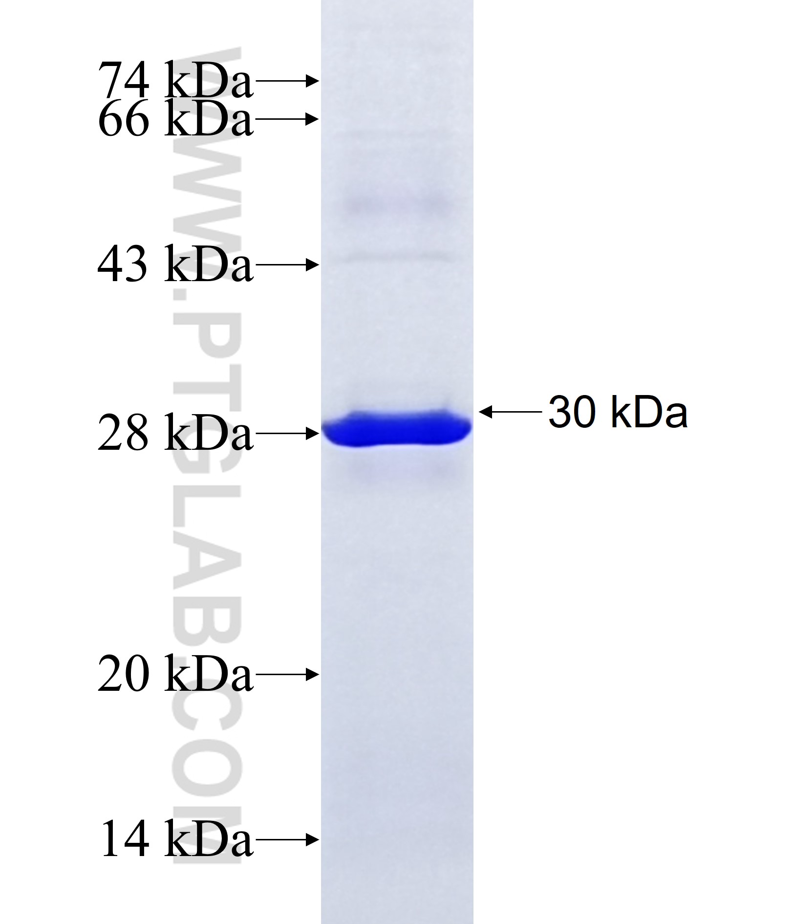 MYO1H fusion protein Ag37151 SDS-PAGE MYO1H fusion protein Ag37151 SDS-PAGE