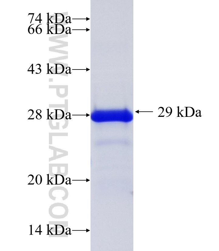 MYO3B fusion protein Ag36195 SDS-PAGE