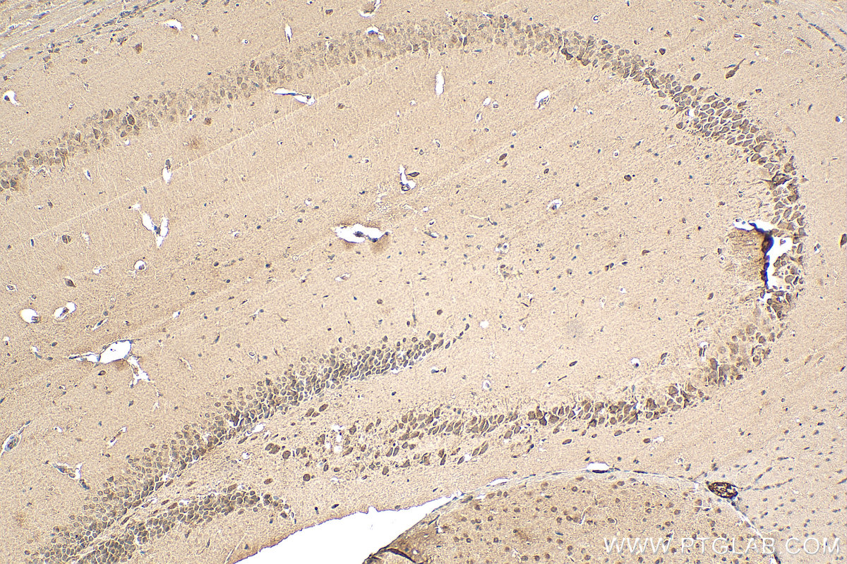 IHC staining of mouse brain using 55318-1-AP