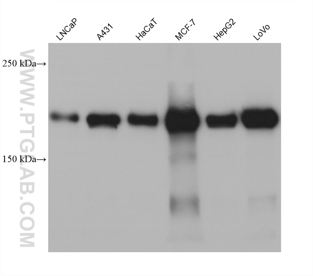 WB analysis using 60402-8-Ig WB analysis using 60402-8-Ig