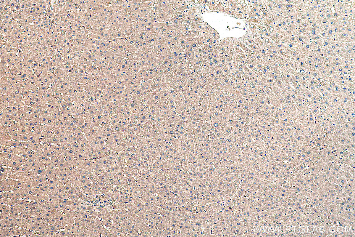 IHC staining of human liver using 20720-1-AP