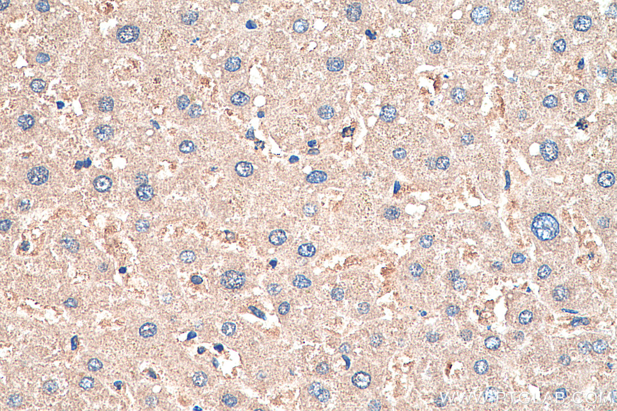 IHC staining of human liver using 20720-1-AP