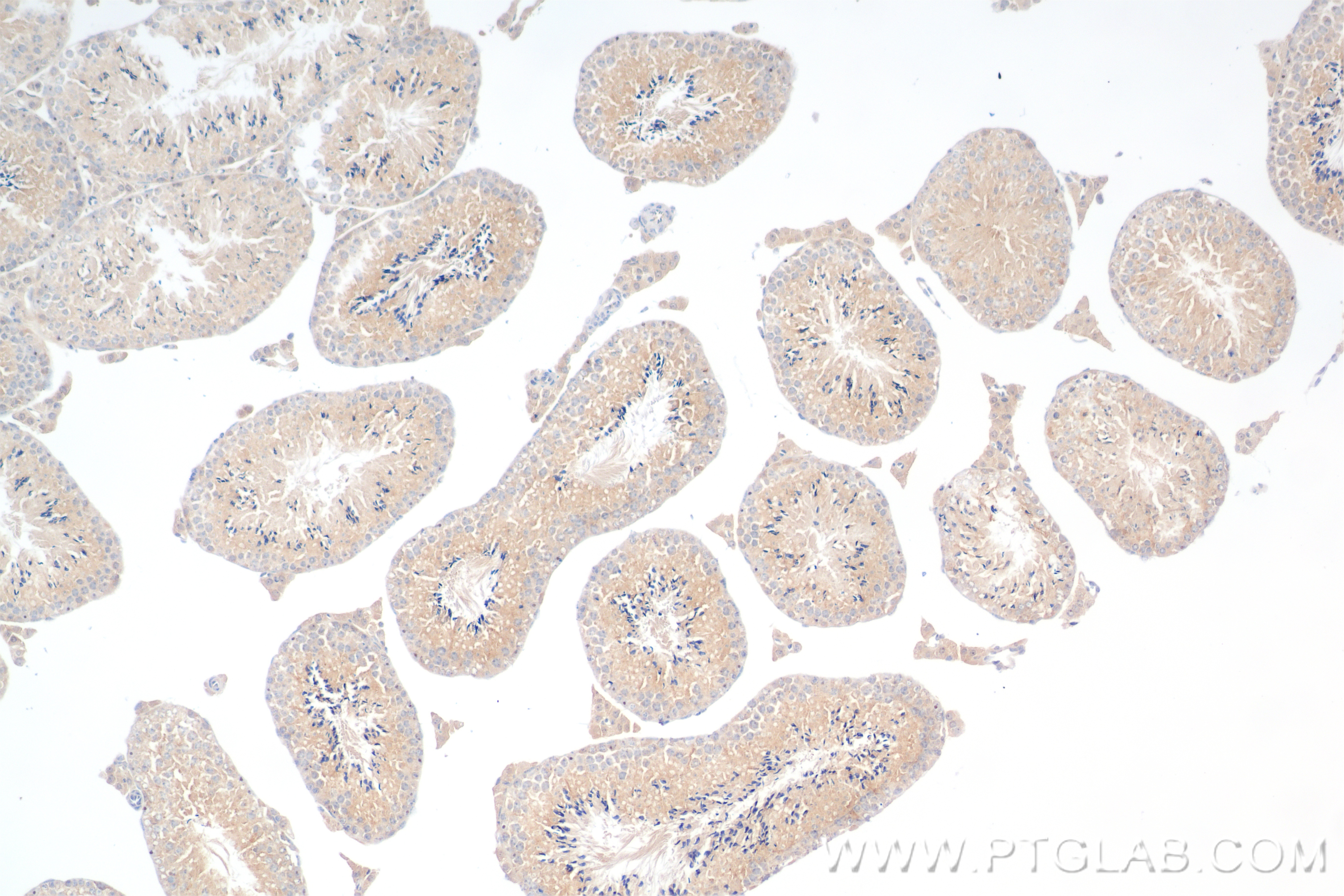 IHC staining of mouse testis using 83807-1-RR (same clone as 83807-1-PBS)