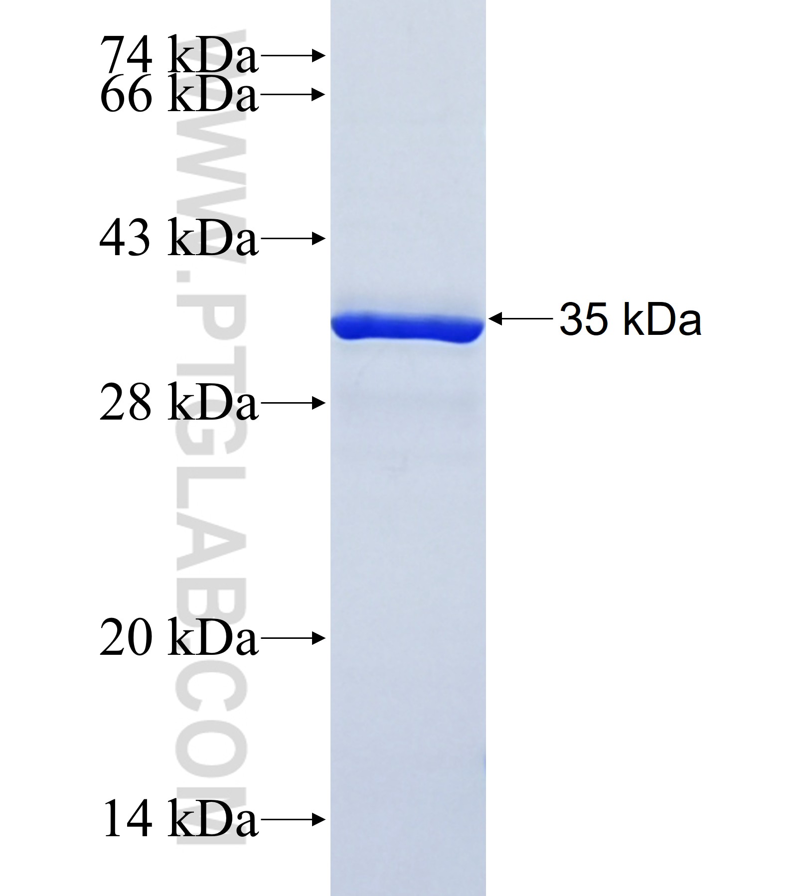 MYO7A fusion protein Ag41975 SDS-PAGE