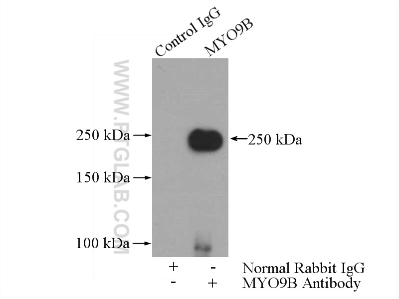 IP experiment of HepG2 using 12432-1-AP