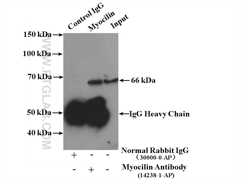 IP experiment of mouse skeletal muscle using 14238-1-AP