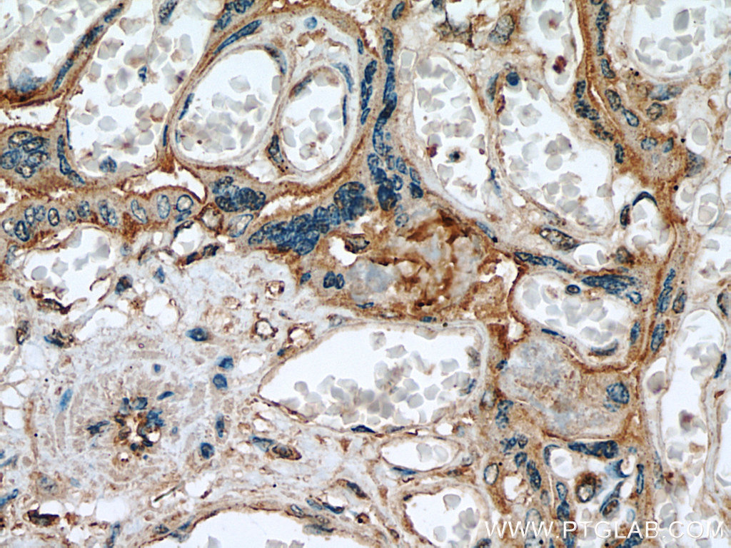 IHC staining of human placenta using 19548-1-AP