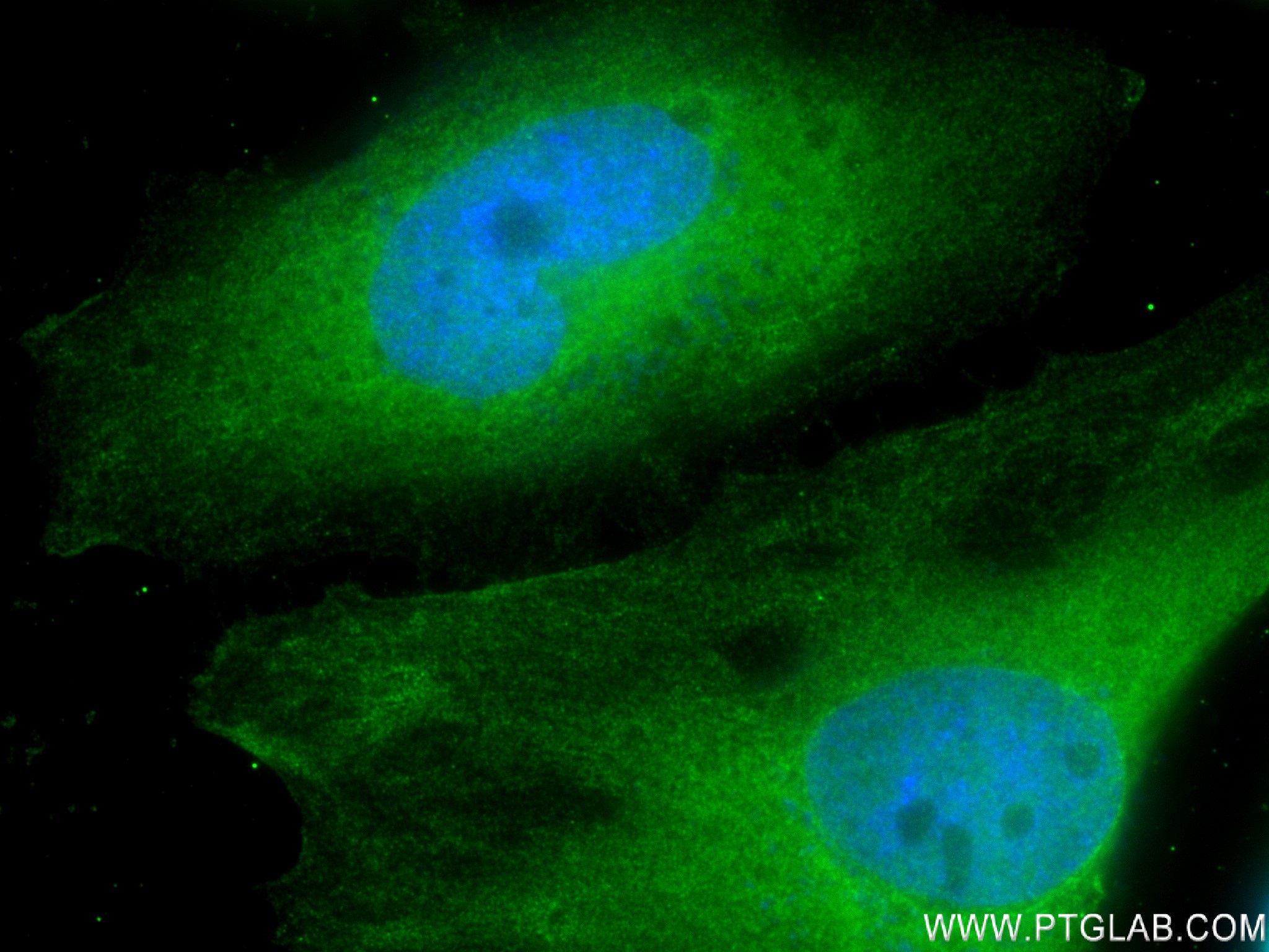 IF Staining of HeLa using 82917-7-RR