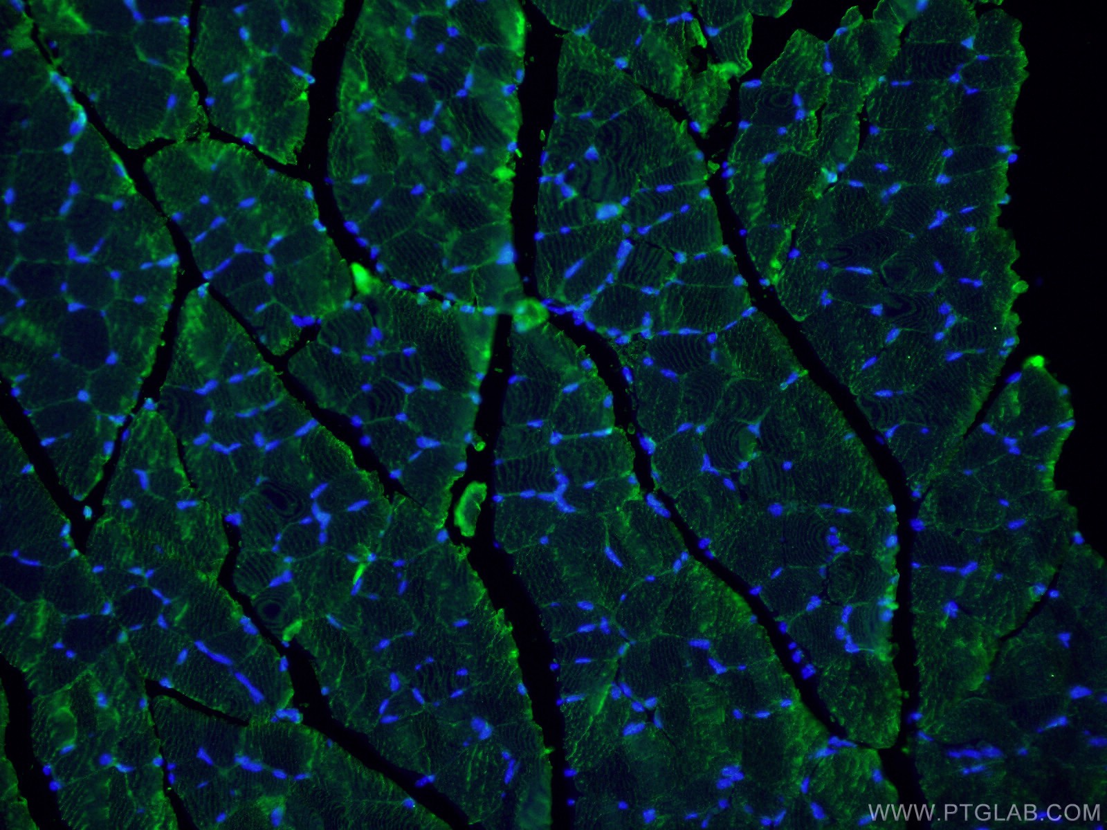 IF Staining of mouse skeletal muscle using 20360-1-AP