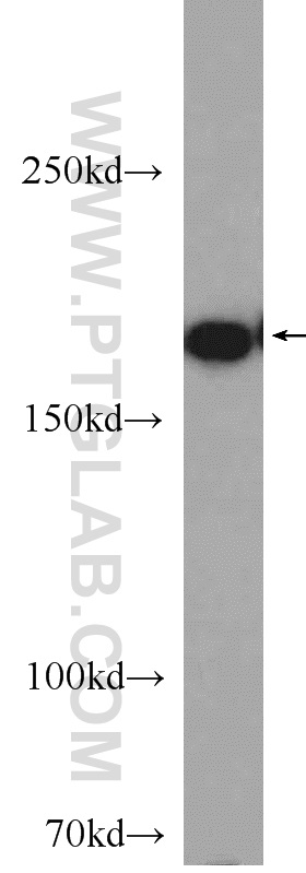 WB analysis of mouse skeletal muscle using 20360-1-AP