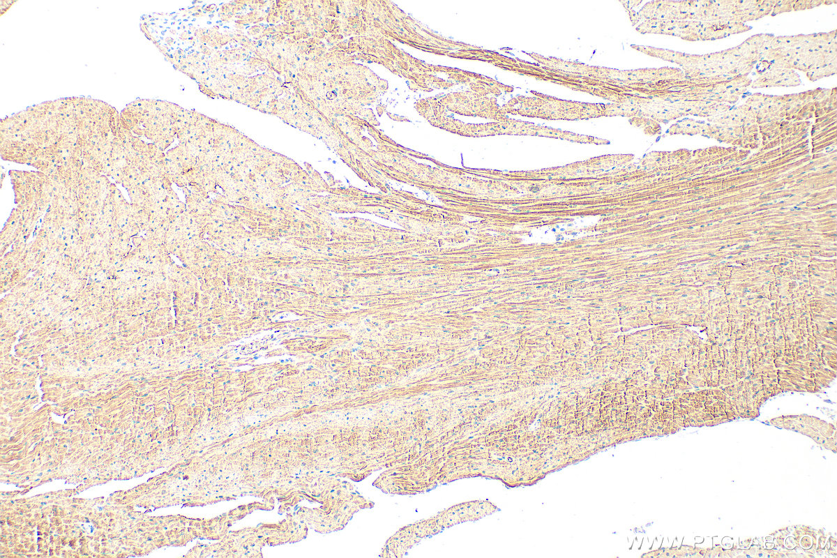 IHC staining of mouse heart using 32262-1-AP (same clone as 32262-1-PBS) IHC staining of mouse heart using 32262-1-AP (same clone as 32262-1-PBS)