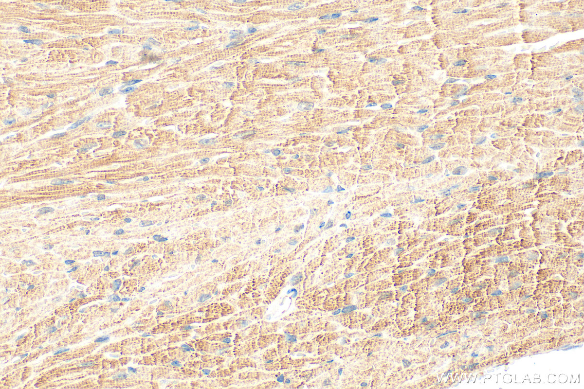 IHC staining of mouse heart using 32262-1-AP (same clone as 32262-1-PBS) IHC staining of mouse heart using 32262-1-AP (same clone as 32262-1-PBS)