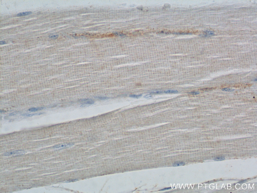 IHC staining of human skeletal muscle using 17692-1-AP