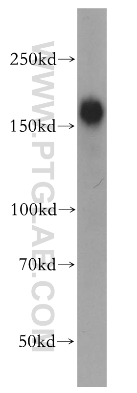 WB analysis of mouse skeletal muscle using 17692-1-AP