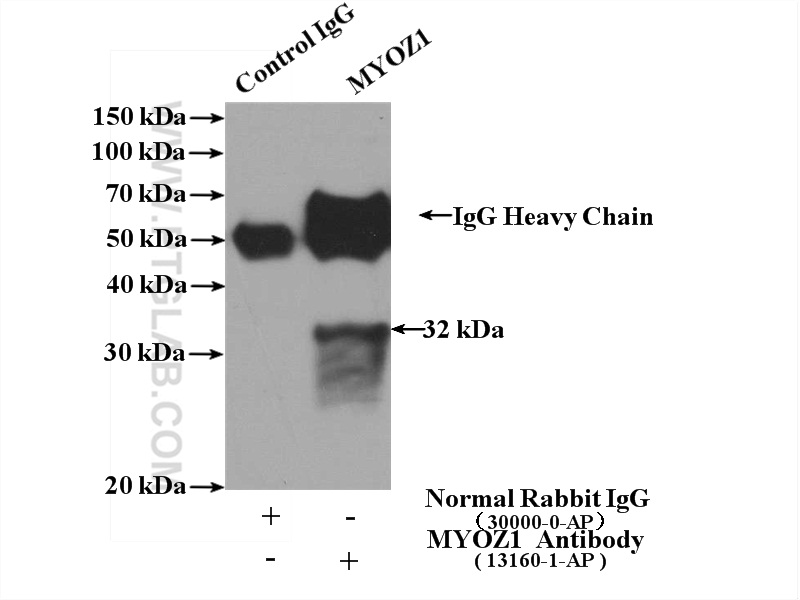 IP experiment of mouse skeletal muscle using 13160-1-AP