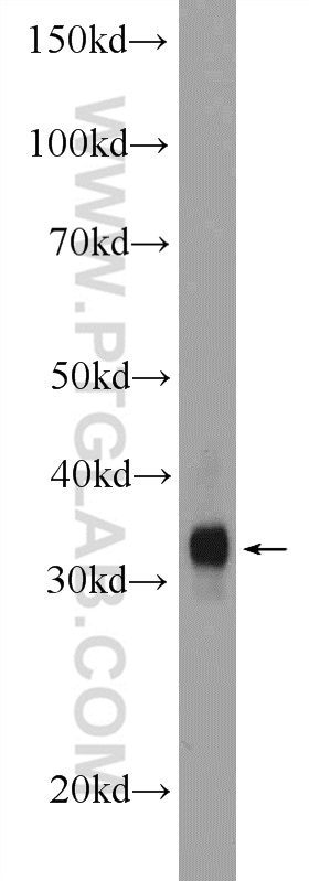 WB analysis of mouse skeletal muscle using 13160-1-AP