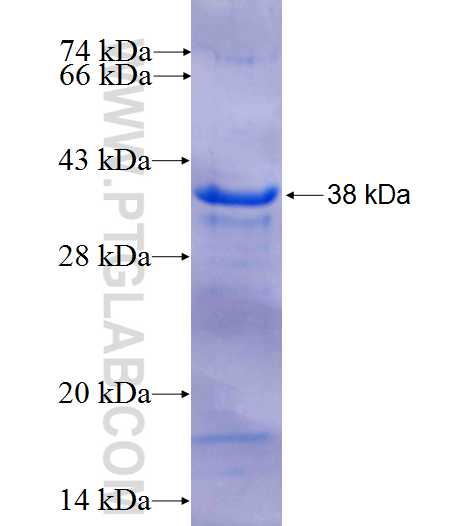 MYOZ1 fusion protein Ag25171 SDS-PAGE MYOZ1 fusion protein Ag25171 SDS-PAGE