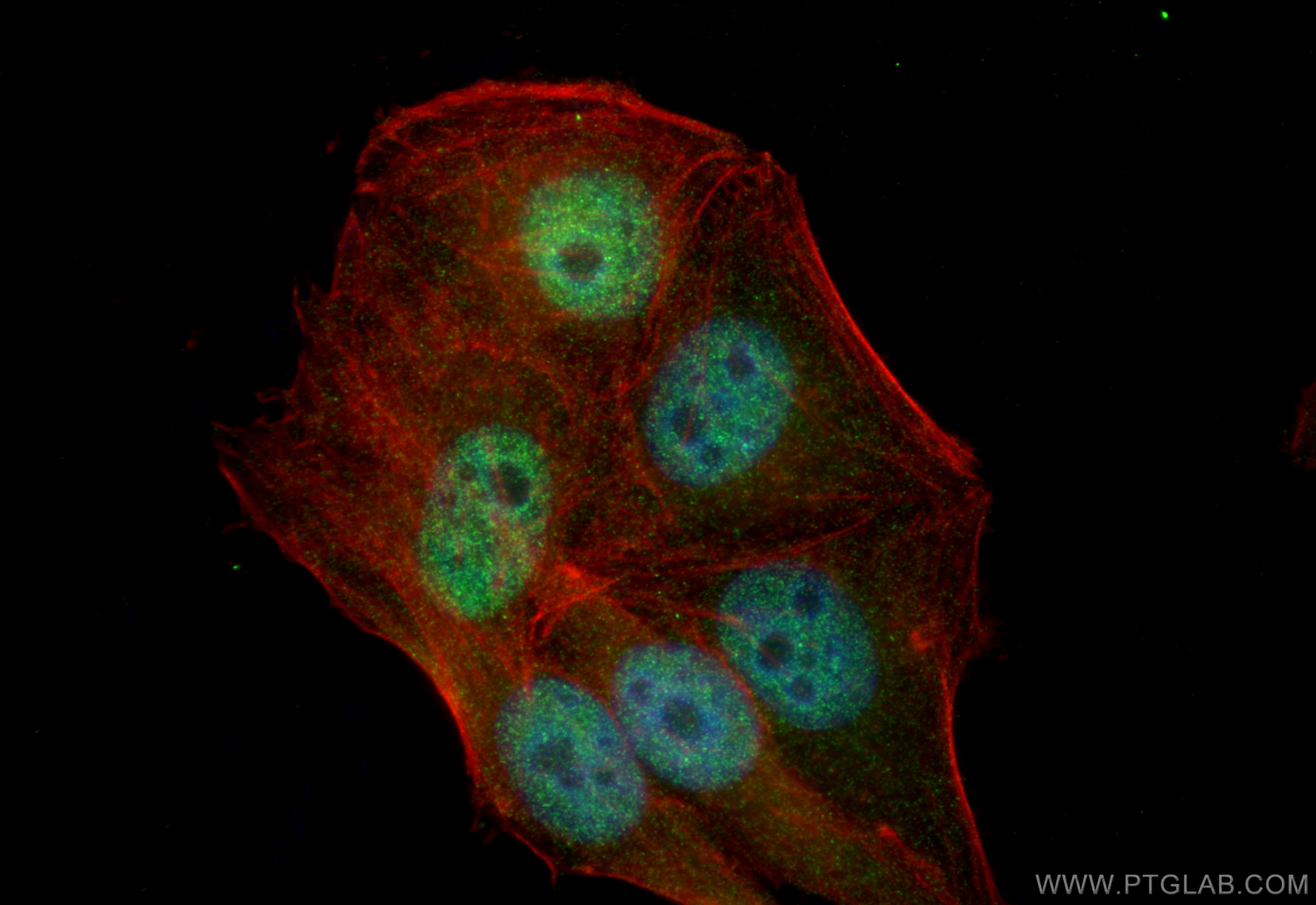 IF Staining of HepG2 using 16180-1-AP