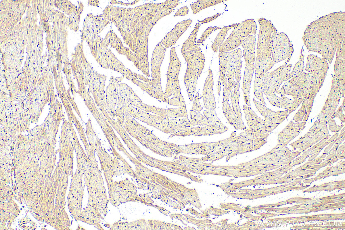 IHC staining of mouse heart using 16180-1-AP