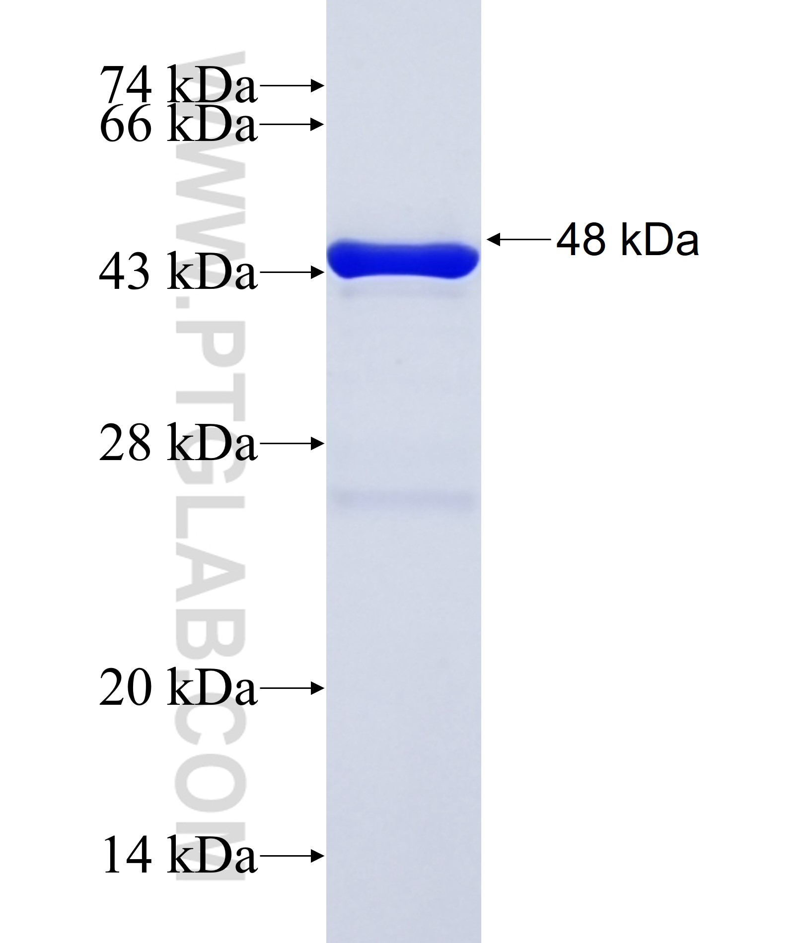 MYPOP fusion protein Ag38135 SDS-PAGE MYPOP fusion protein Ag38135 SDS-PAGE