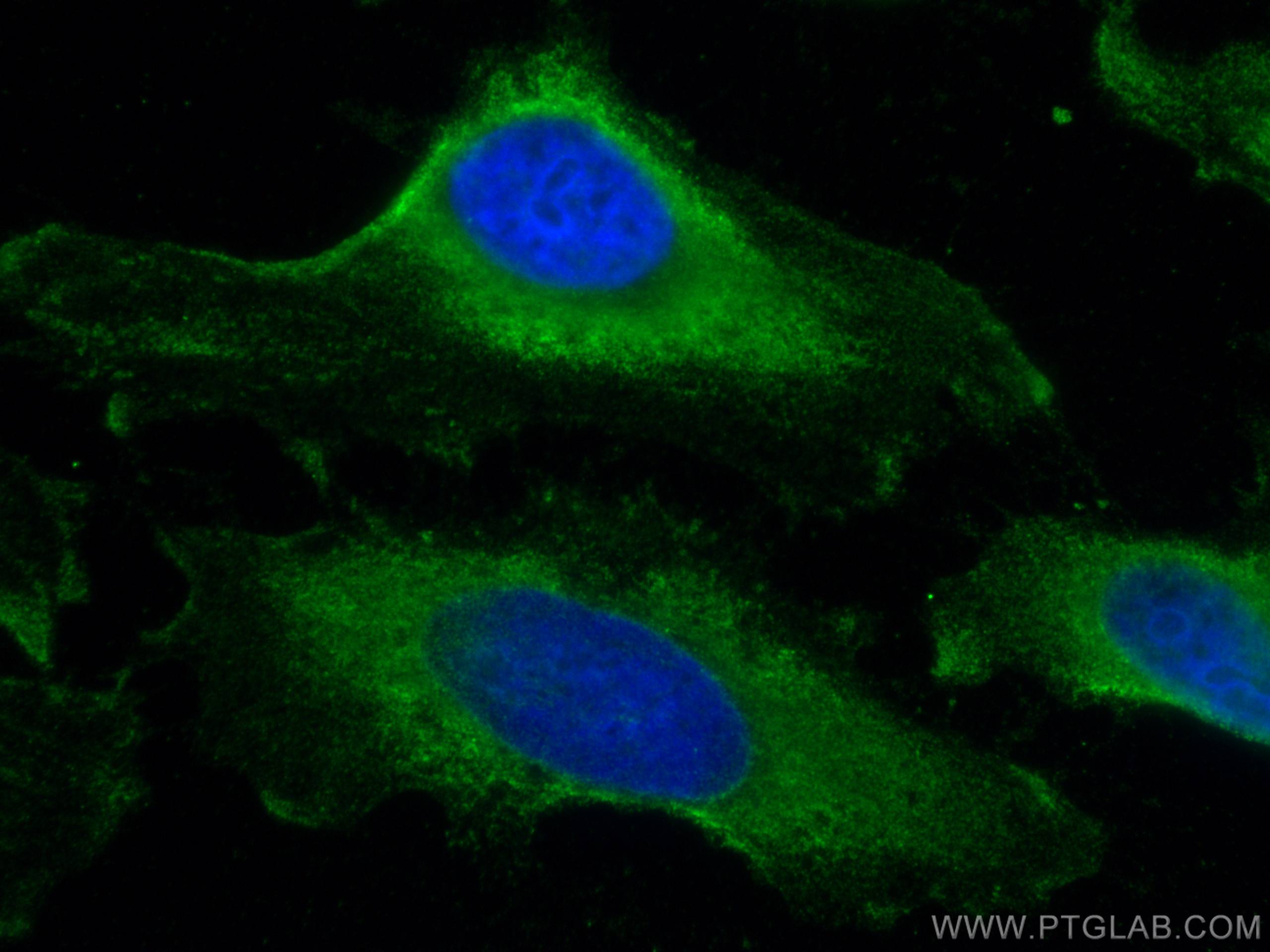 IF Staining of HeLa using 66506-1-Ig (same clone as 66506-1-PBS)