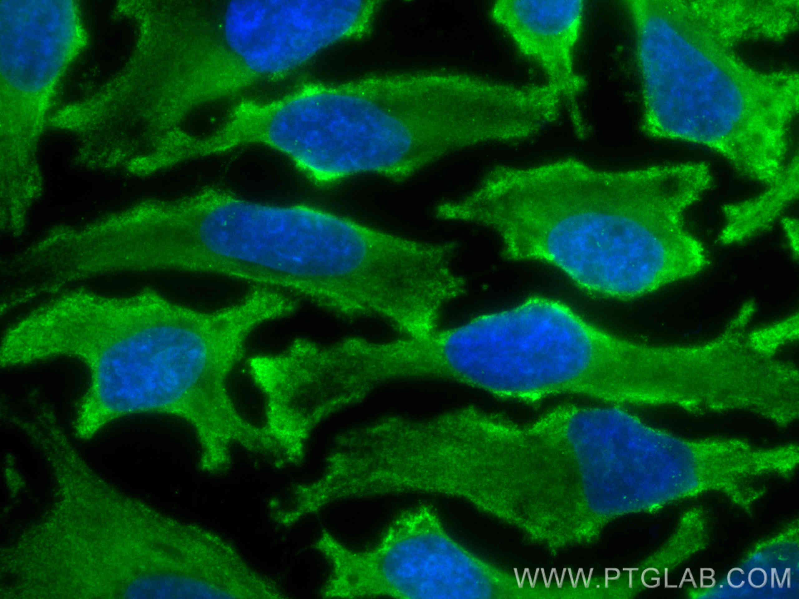 IF Staining of HeLa using CL488-66506