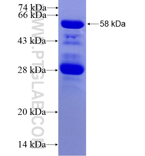 MYPT1 fusion protein Ag16072 SDS-PAGE MYPT1 fusion protein Ag16072 SDS-PAGE