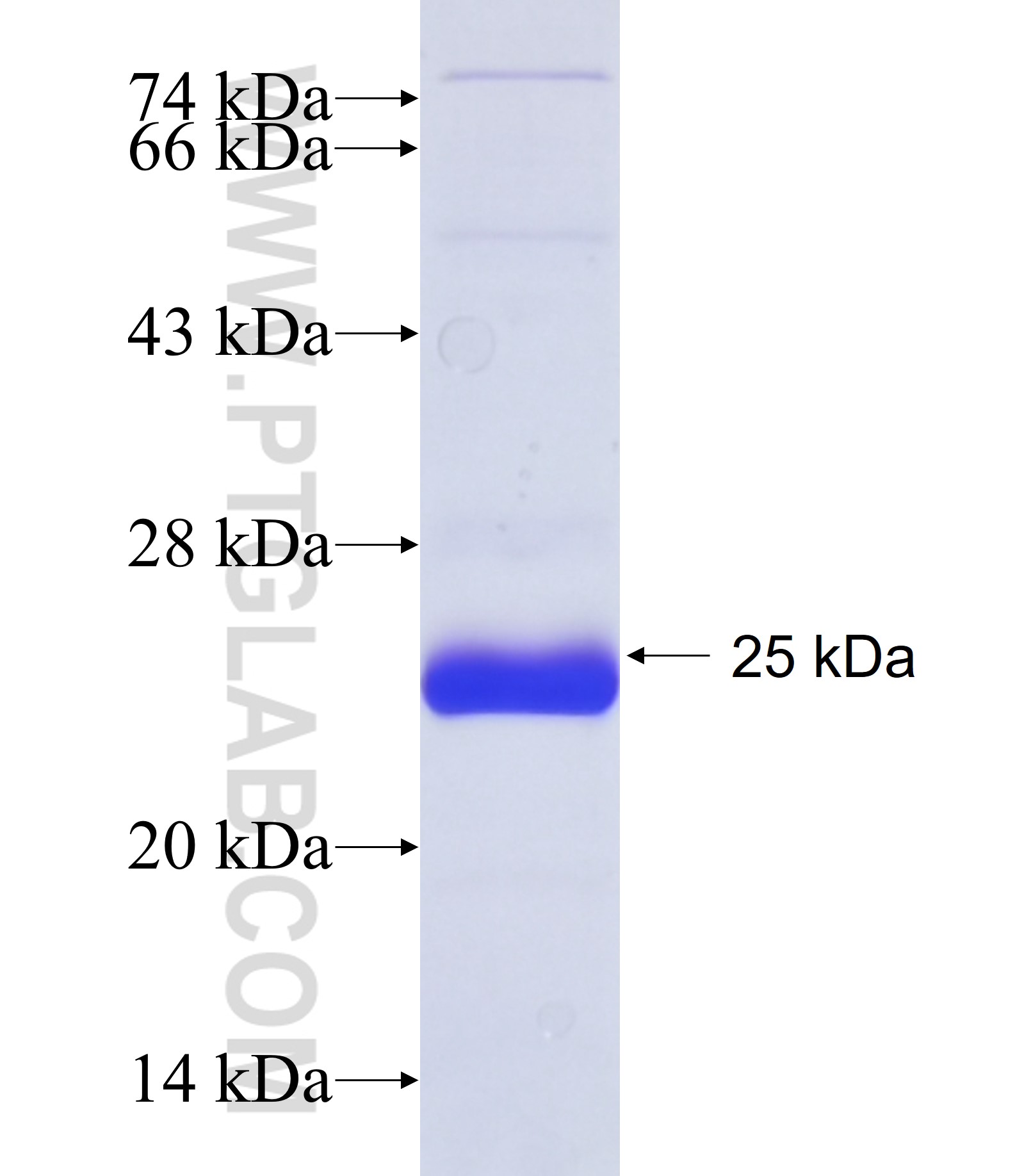 MYRF fusion protein Ag34685 SDS-PAGE MYRF fusion protein Ag34685 SDS-PAGE