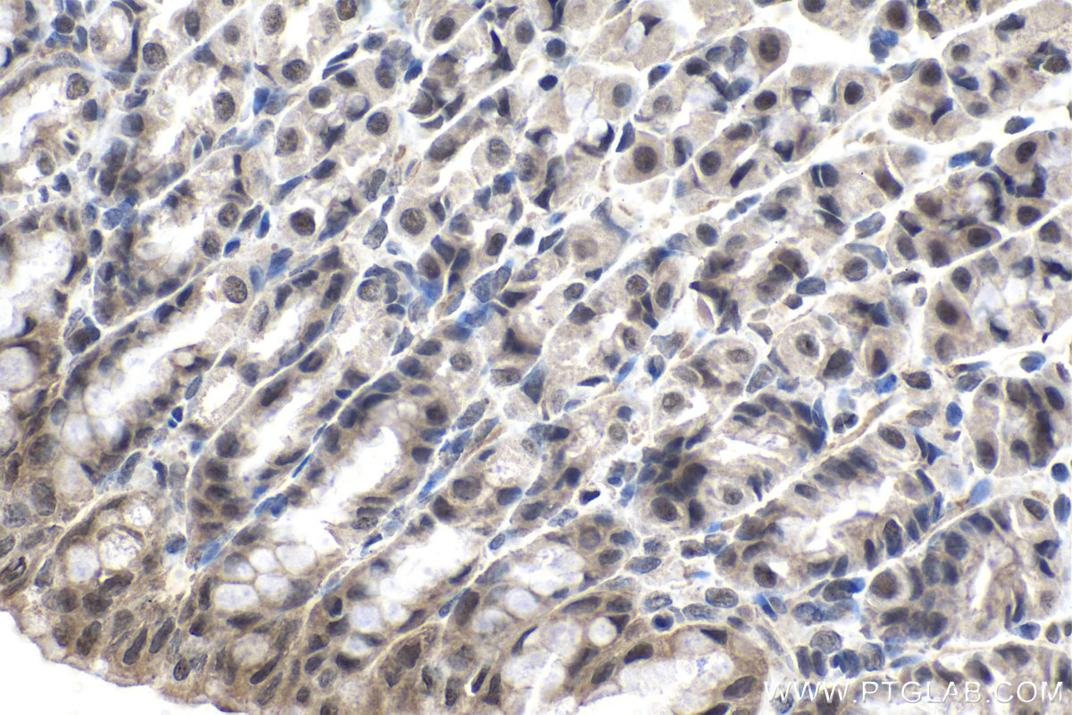 IHC staining of rat stomach using 13751-1-AP