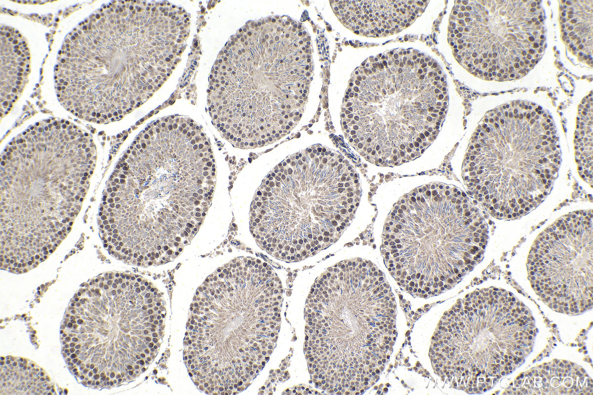 IHC staining of rat testis using 13751-1-AP