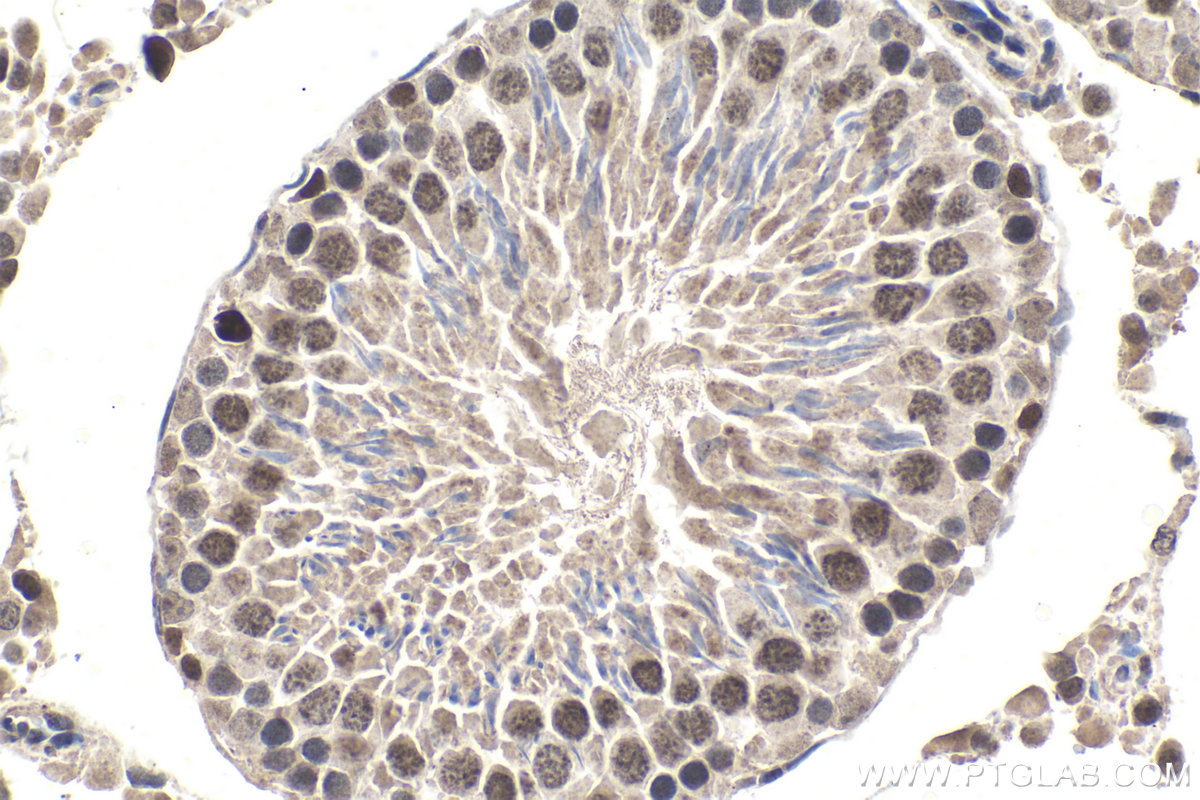 IHC staining of rat testis using 13751-1-AP