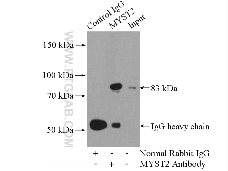 IP experiment of HeLa using 13751-1-AP