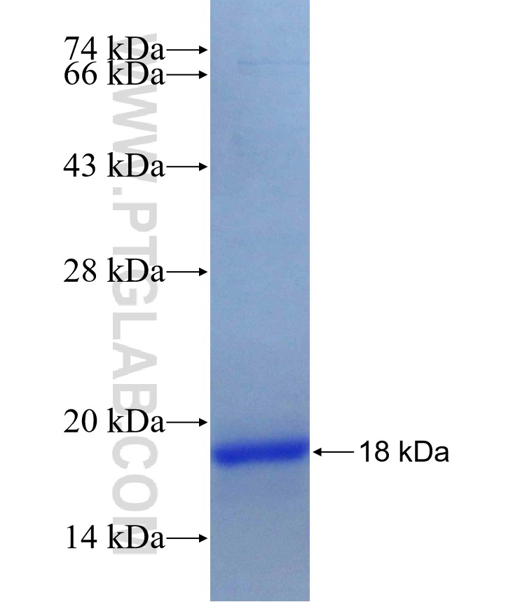 MYST3 fusion protein Ag29744 SDS-PAGE