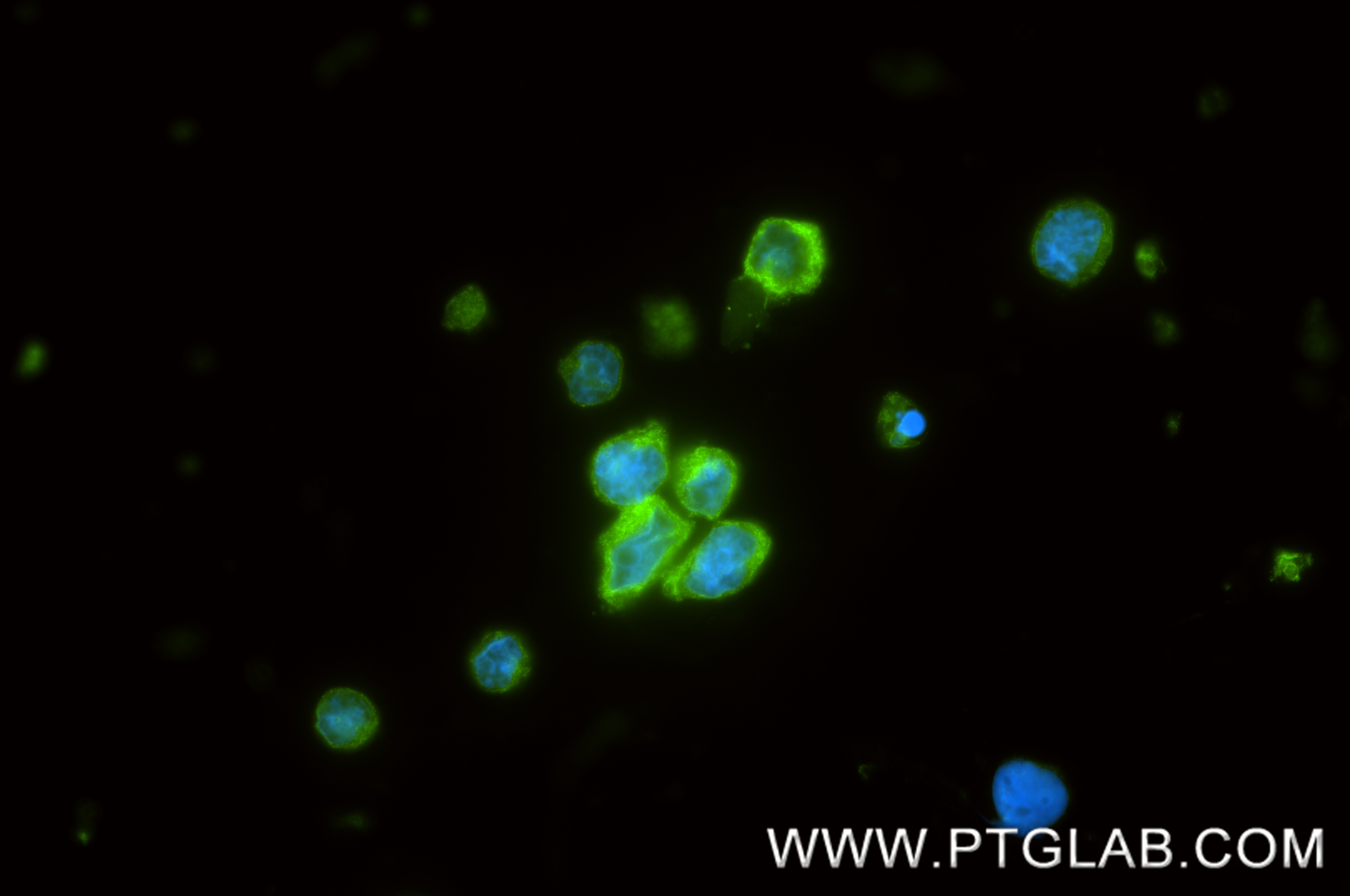 IF Staining of Raji using 88201-1-RR