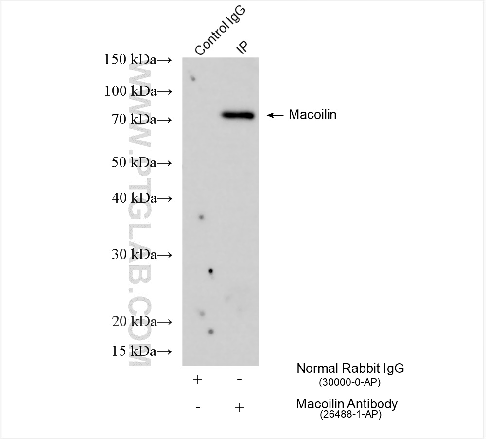 IP experiment of Neuro-2a using 26488-1-AP