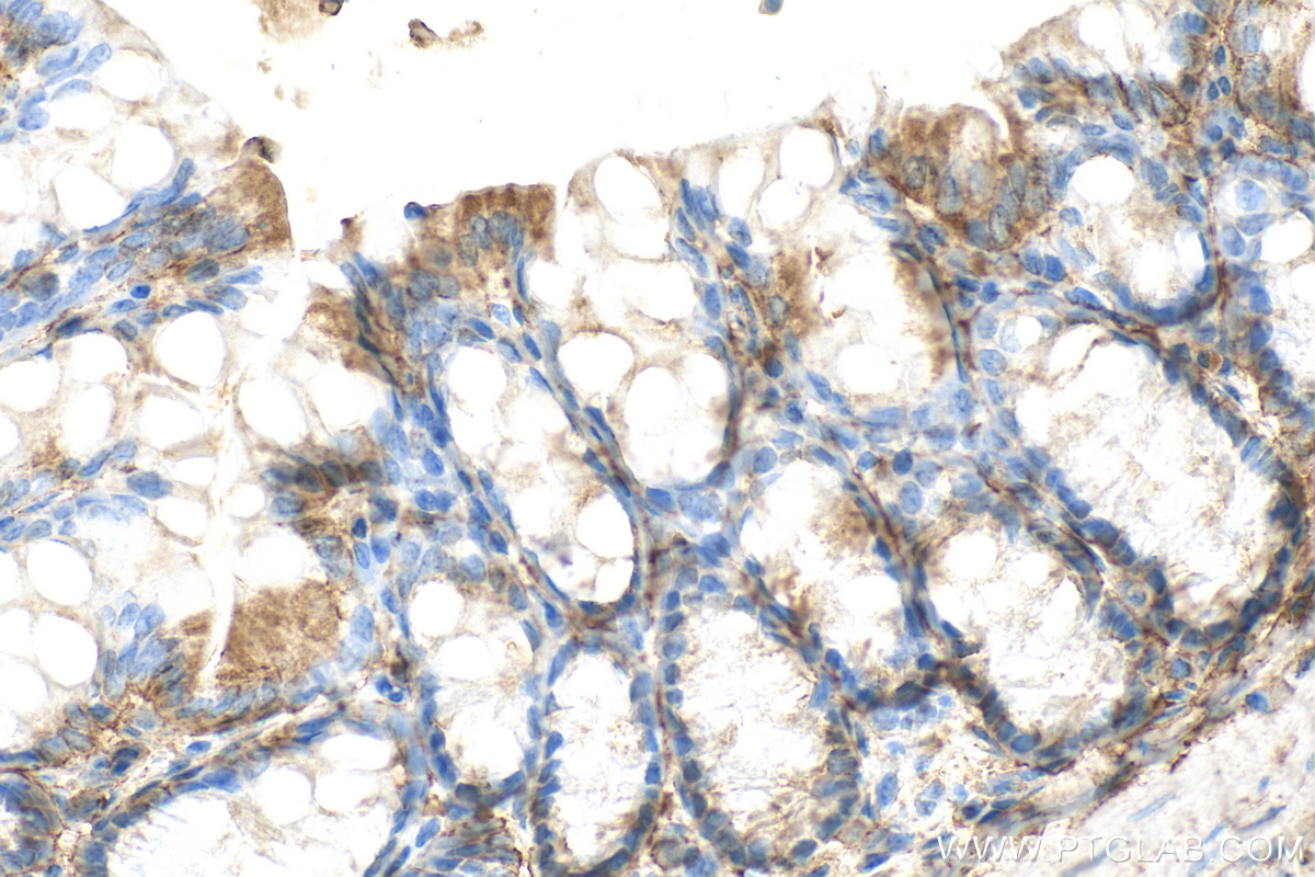 Immunohistochemical analysis of paraffin-embedded mouse colon tissue slide using 26655-1-AP (Malectin antibody) at dilution of 1:200 (under 40x lens). Heat mediated antigen retrieval with Tris-EDTA buffer (pH 9.0). IHC staining of mouse colon using 26655-1-AP